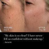 4D Pro Ultimate LED Mask