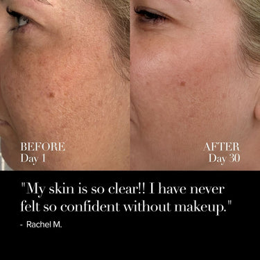 4D Pro Ultimate LED Mask