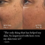 4D Pro Ultimate LED Mask