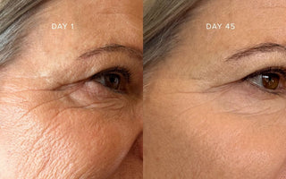 82% Reported Softer-Looking Fine Lines In 6 Weeks: What Our Study Revealed About Our New Advanced Pro LED Face Mask
