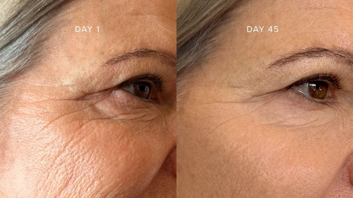 82% Reported Softer-Looking Fine Lines In 6 Weeks: What Our Study Revealed About Our New Advanced Pro LED Face Mask