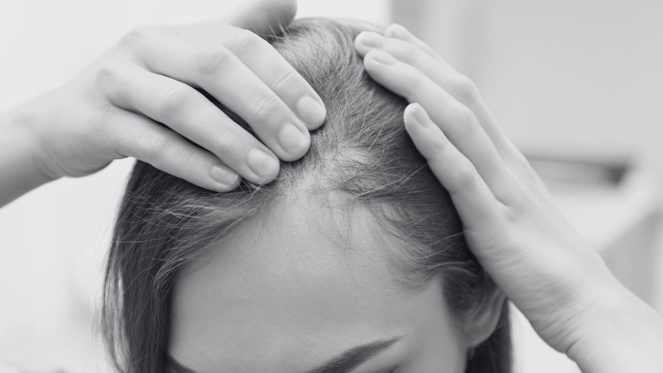 Hair damage + Loss