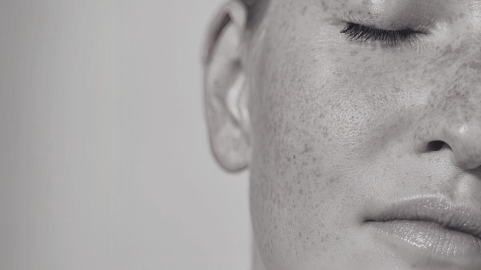 Hyperpigmentation - The Skincare Tools
