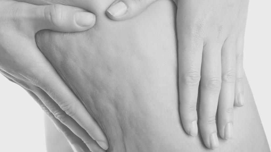 Skin Tightening - The Skincare Tools