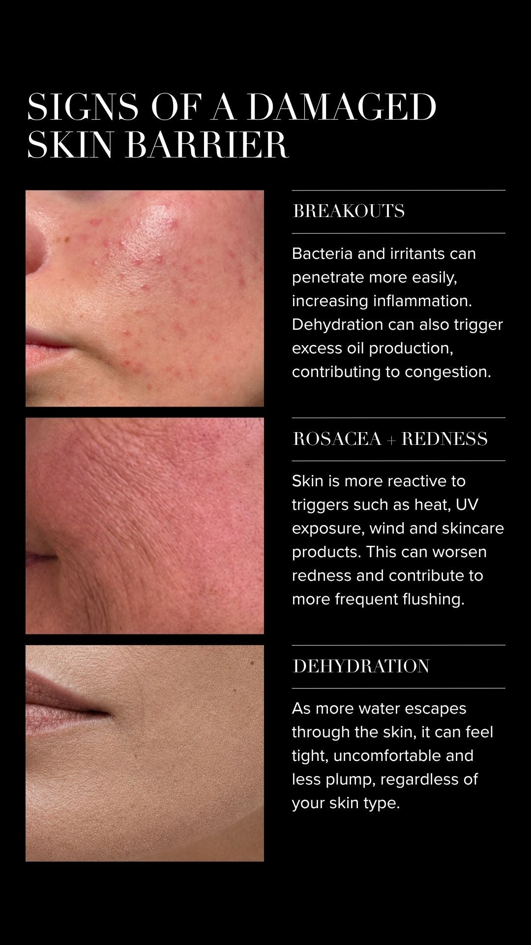 how to repair a damaged skin barrier	