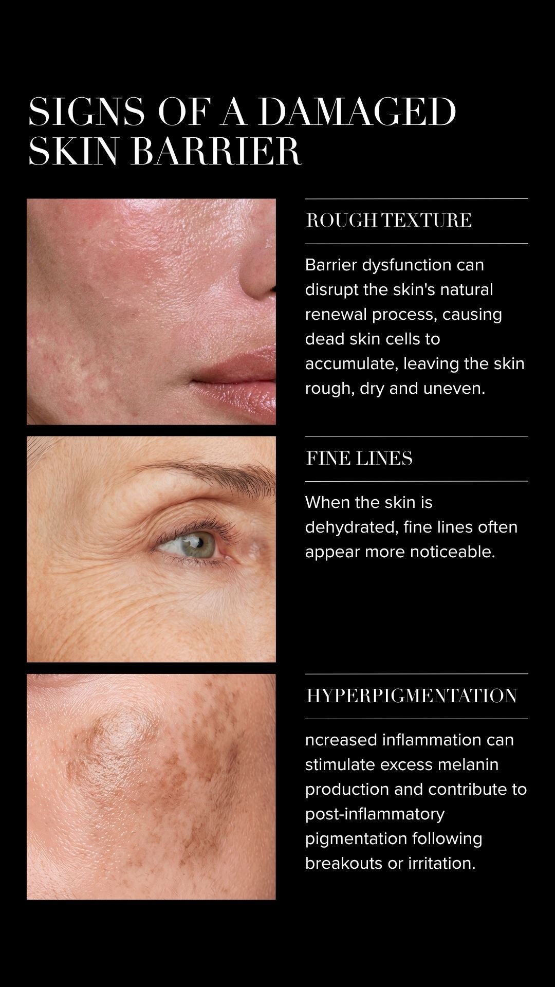 what does a damaged skin barrier look like