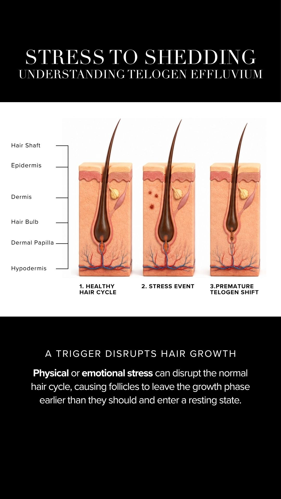 HOW STRESS AFFECTS HAIR GROWTH PROCESS