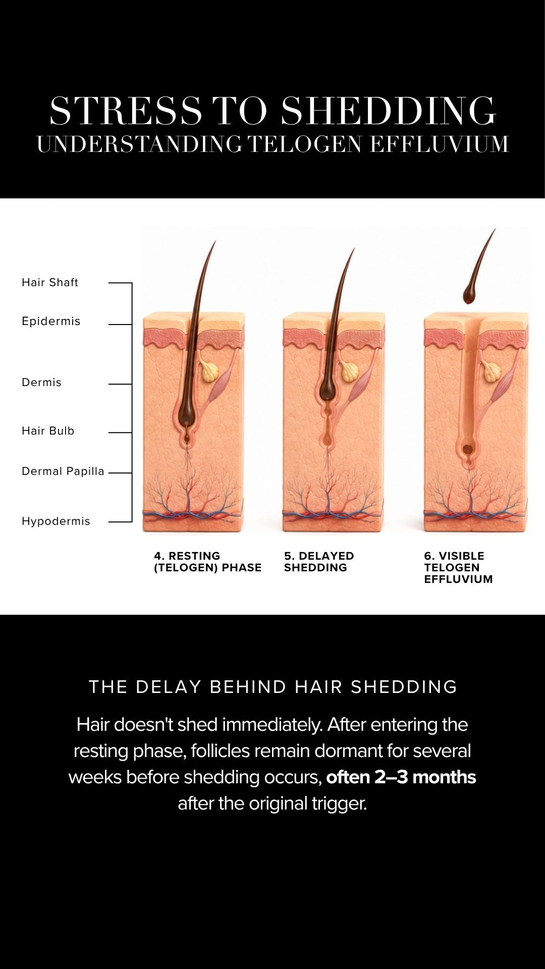 how stress affects hair shedding
