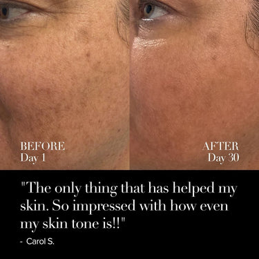 4D Pro Ultimate LED Mask