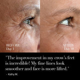 4D Pro Ultimate LED Mask