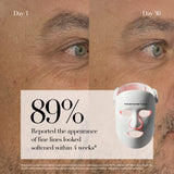 4D Pro Ultimate LED Mask