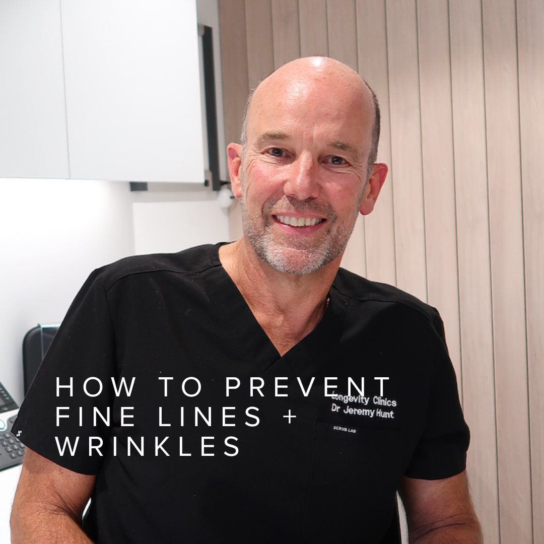 How To Prevent Fine Lines + Wrinkles