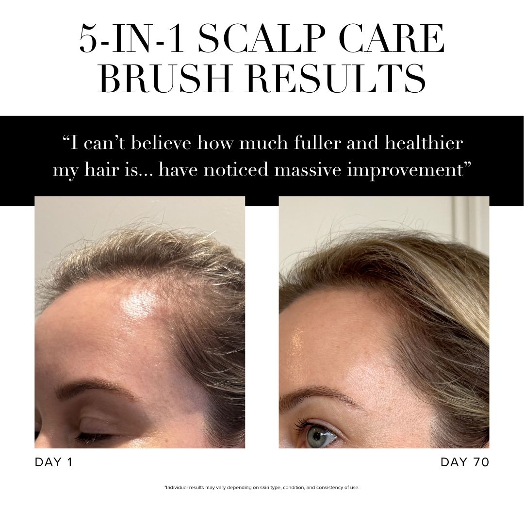 does glp 1 cause hair loss before and after
