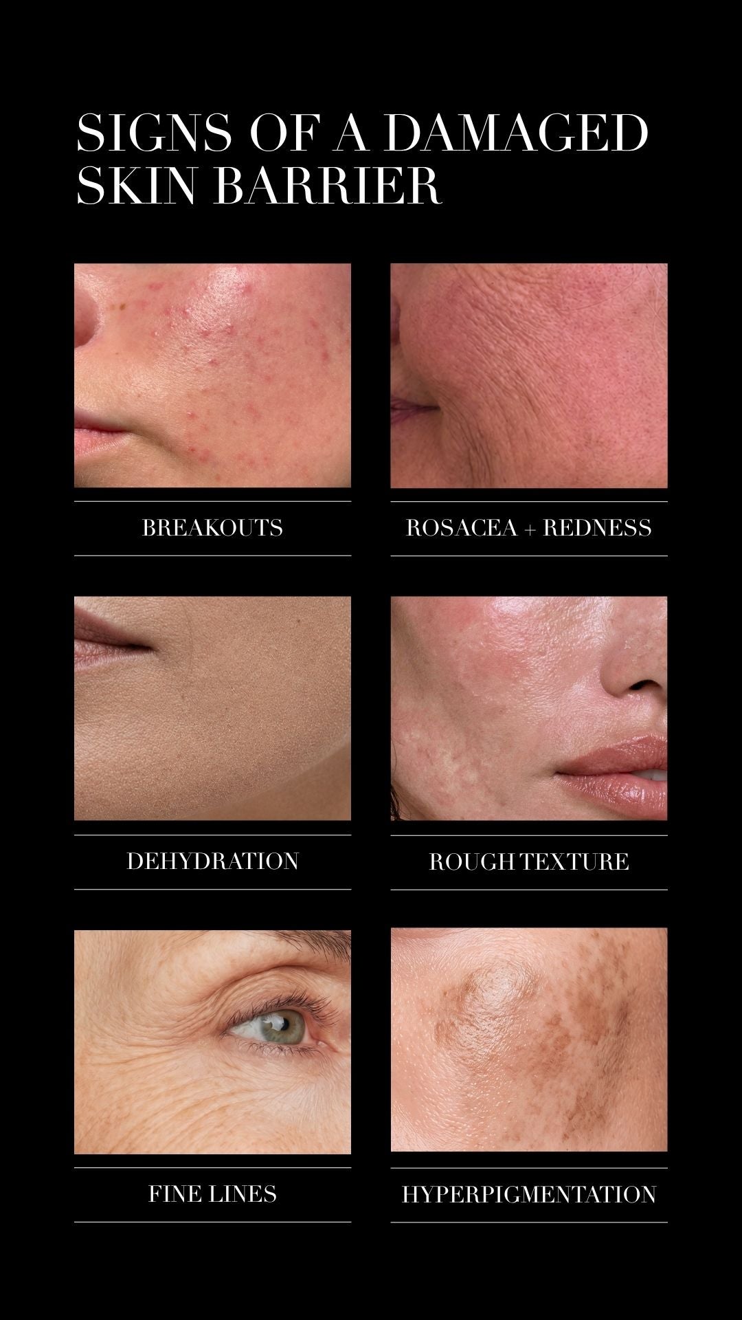 what does a damaged skin barrier look like